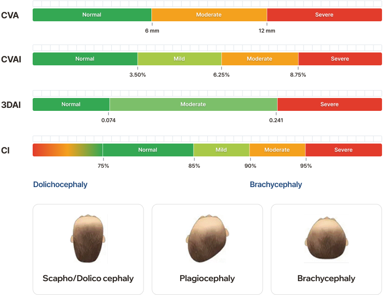 Severity classification chart showing CVA, CVAI, 3DAI and CI severity levels with Dolichocephaly, Plagiocephaly, and Brachycephaly examples