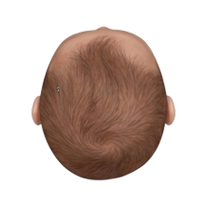 Mild plagiocephaly