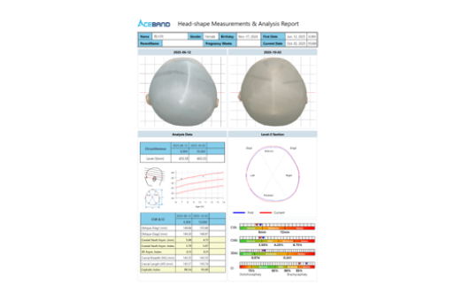3D analysis measurement results