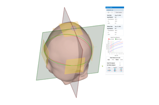 3D corrective model generation